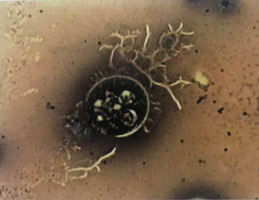 So sehen Blutmykosen aus